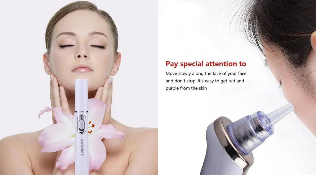 Blue Light Therapy for Acne Do At-Home Devices Really Work? A Review