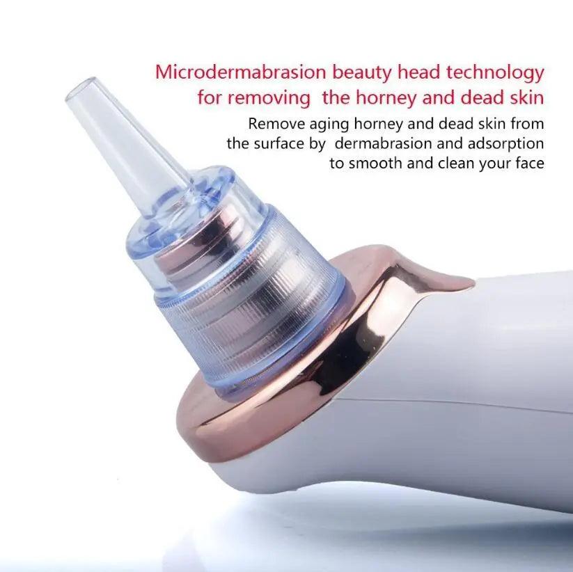 Clear Pore Electric Black head Remover - Glowup