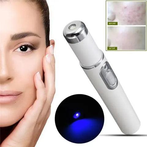 ClearGlow Blue Light Therapy Acne Laser Pen - Glowup