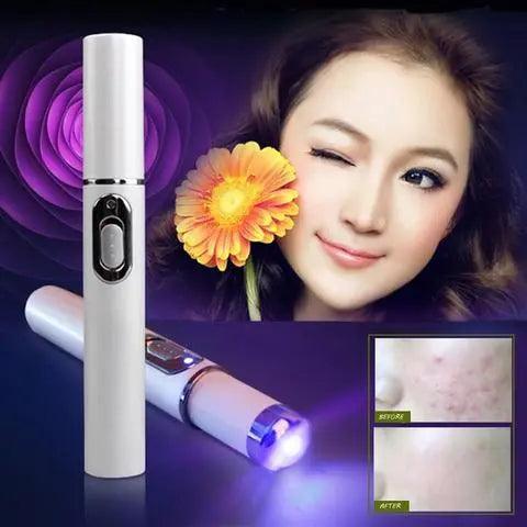 ClearGlow Blue Light Therapy Acne Laser Pen - Glowup