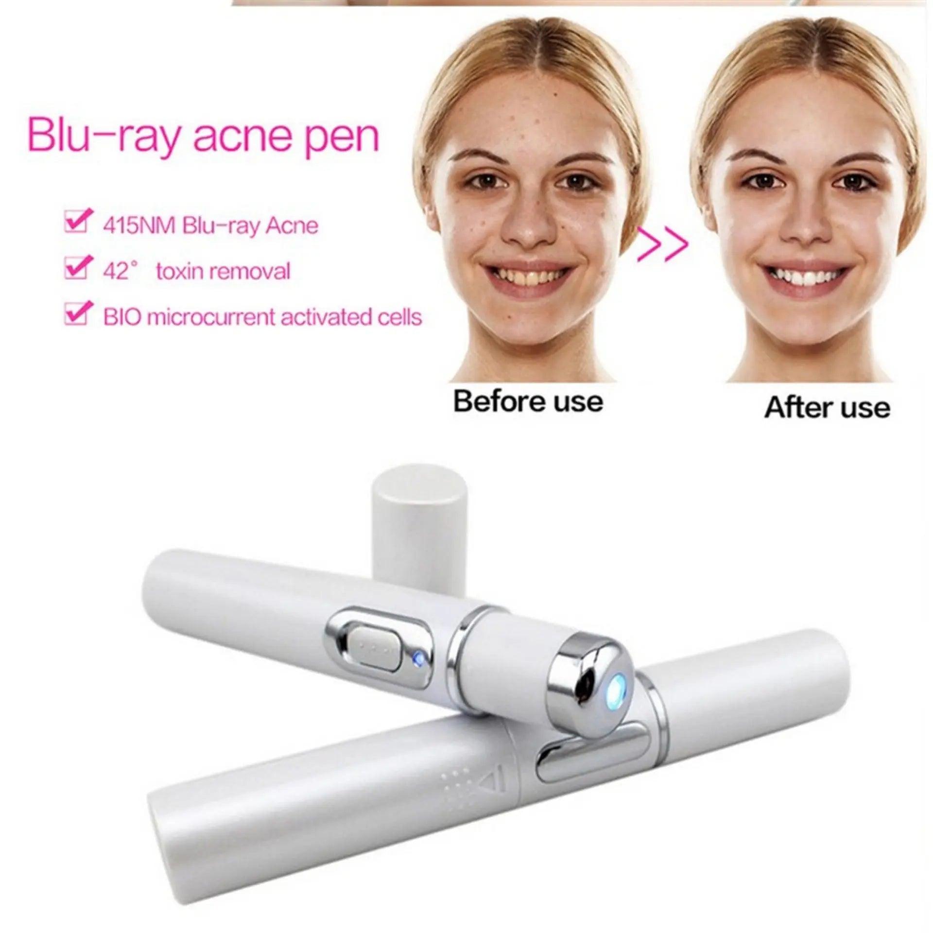 ClearGlow Blue Light Therapy Acne Laser Pen - Glowup